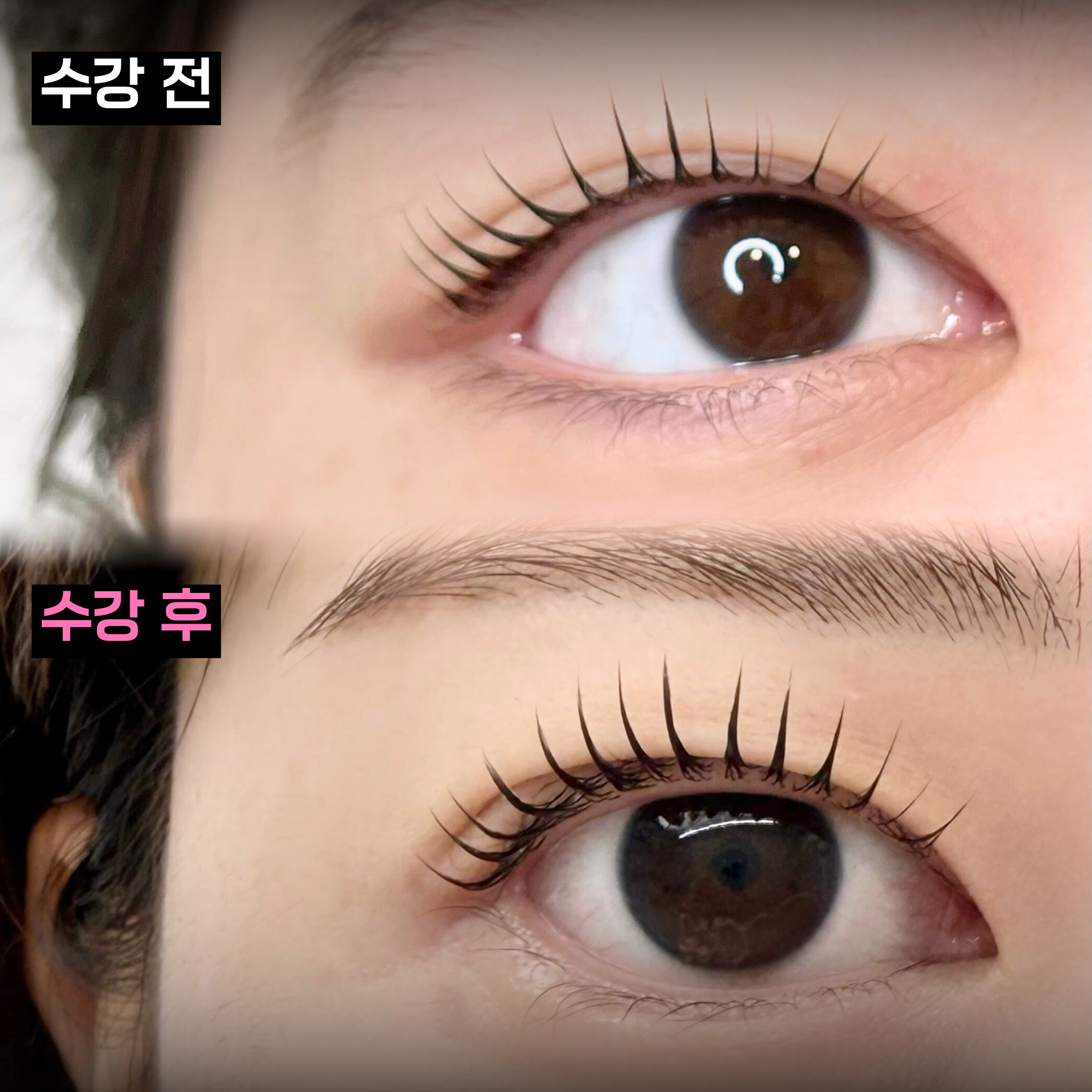 수강생 Before & After 5